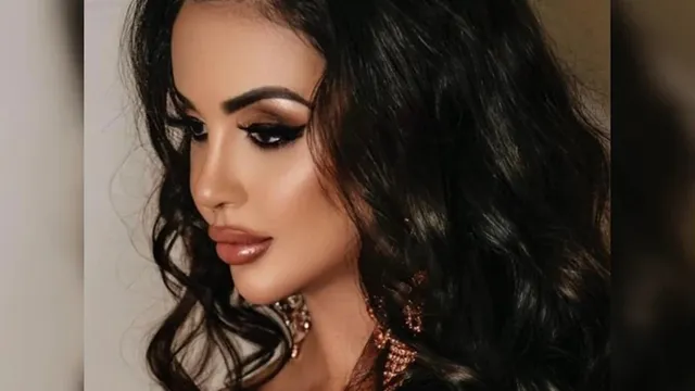 କିିମ୍‌ କଦର୍ସିୟାଁଙ୍କ ପରି ଦିଶିବାକୁ ୪ କୋଟି ଖର୍ଚ୍ଚ କରିବା ପରେ ନିଜ ଚେହେରା ଫେରି ପାଇବାକୁ ୯୫ ଲକ୍ଷ ଟଙ୍କା ଖର୍ଚ୍ଚ କଲେ ମଡେଲ୍‌