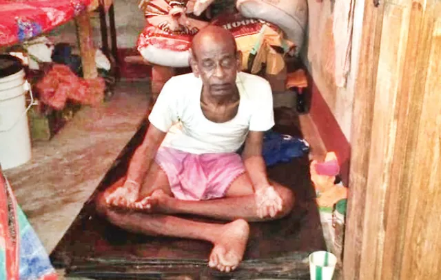 ଆଙ୍ଗୁଠି ନଥିବାରୁ ରାସନ ମିଳୁନି