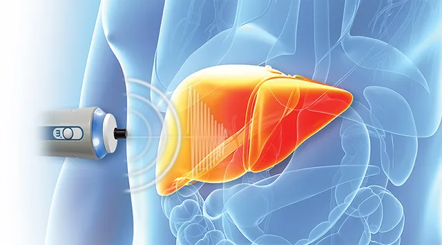 ହେପାଟାଇଟିସ୍‌, ଯକୃତ ଓ ଫାଇବ୍ରୋସ୍କାନ୍‌