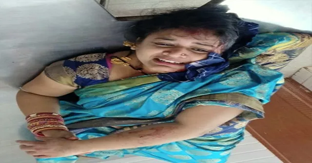 ଚଳନ୍ତା ବାଇକ୍‌ରୁ ମଙ୍ଗଳସୂତ୍ର ଲୁଟ୍‌ ଉଦ୍ୟମ, ଖସିପଡ଼ି ମହିଳା ଓ ଶିଶୁକନ୍ୟା ଗୁରୁତର