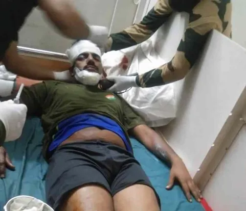 ଲ୍ୟାଣ୍ଡମାଇନ ବିସ୍ଫୋରଣରେ ଯବାନ ଆହତ