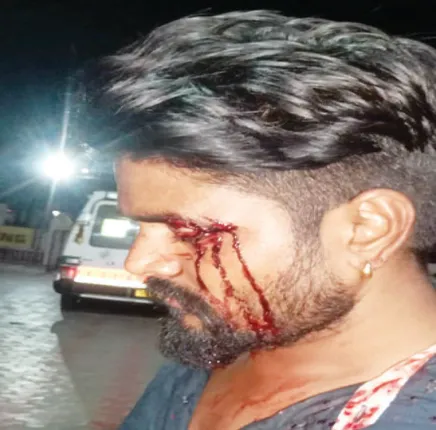 ୨ ପିକ୍‌ନିକ୍‌ ପାର୍ଟି ପିଟାପିଟି