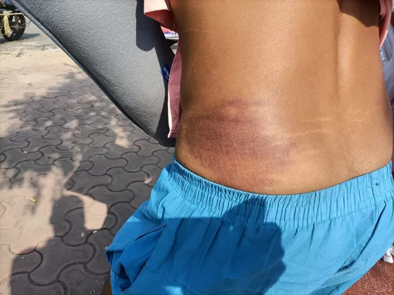 ଥାନାରେ ଯୁବକଙ୍କୁ ଥାର୍ଡ ଡିଗ୍ରୀ ! ପତ୍ନୀଙ୍କ ସାମ୍ନାରେ ଲାଠିମାଡରେ ହାତ ଭାଙ୍ଗିଦେଲେ