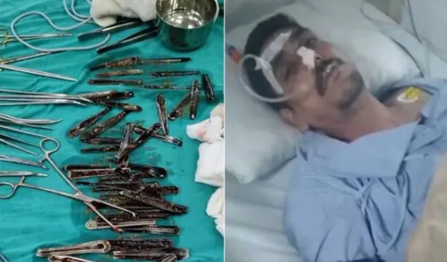 ନିଶାମୁକ୍ତି କେନ୍ଦ୍ରରେ ଅସୁସ୍ଥ ହେବା ପରେ ଯୁବକଙ୍କୁ ହସ୍ପିଟାଲ ନେବାରୁ ପେଟରୁ ବାହାରିଲା ୬୦ରୁ ଊର୍ଧ୍ବ ଚାମଚ