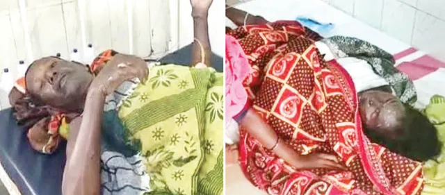 ଶୋଇଥିବା ବେଳେ ଘର ଜାଳିଦେଲା ଦୁର୍ବୃତ୍ତ! ଅର୍ଦ୍ଧଦଗ୍ଧ ଅବସ୍ଥାରେ ଦମ୍ପତି ଉଦ୍ଧାର