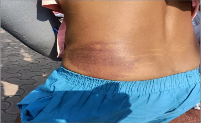 ଥାନାରେ ଯୁବକଙ୍କୁ ଥାର୍ଡ ଡିଗ୍ରୀ! ପତ୍ନୀଙ୍କ ସାମ୍ନାରେ ଲାଠିରେ ପିଟିଲେ, ହାତ ଭାଙ୍ଗିଦେଲେ