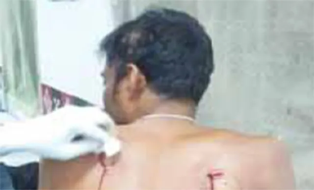 ପେଟ୍ରୋଲ ପମ୍ପରେ ବୋମାମାଡ଼; ଦେଢ଼ଲକ୍ଷ ଲୁଟ୍‌, ୩ ଆହତ