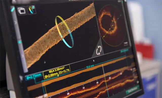 ନୂଆ ସମୟ ନୂଆ କଥା - ୨୦ ସେକେଣ୍ଡରେ ଜଣାପଡ଼ିବ ହୃଦ୍‌ରୋଗ