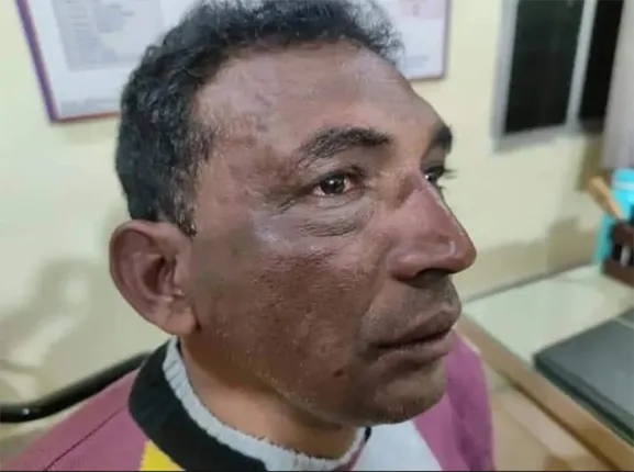 ବର୍ବରତାର ସୀମା ଟପିଲା ବରଗଡ଼ ପୁଲିସ୍‌: ସାମ୍ବାଦିକଙ୍କୁ ନିର୍ମମ ମାଡ଼