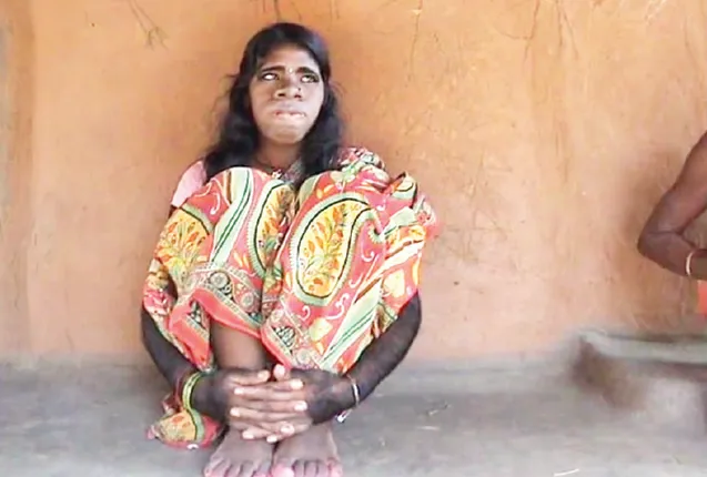 ଲୋମଶକନ୍ୟା ରେବତୀ ଏବେ ଅସହାୟ