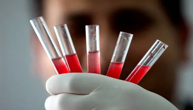 ଖୋଲା ଝରକା: ଗୋଲ୍‌ଡେନ୍‌ ବ୍ଲଡ୍‌