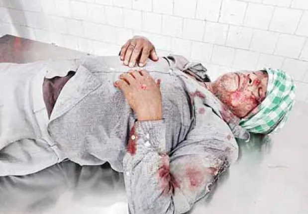 ଭଲ ଖବର: ଦୁର୍ଘଟଣାଗ୍ରସ୍ତଙ୍କୁ ନିଜ ଗାଡ଼ିରେ ଡାକ୍ତରଖାନା ନେଲେ ତହସିଲଦାର