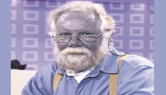 ନୀଳ ମଣିଷ କାରାସନ୍: ଏହି କାରଣରୁ ଦେହର ରଙ୍ଗ ଧଳାରୁ ପାଲଟିଯାଇଥିଲା ନୀଳ