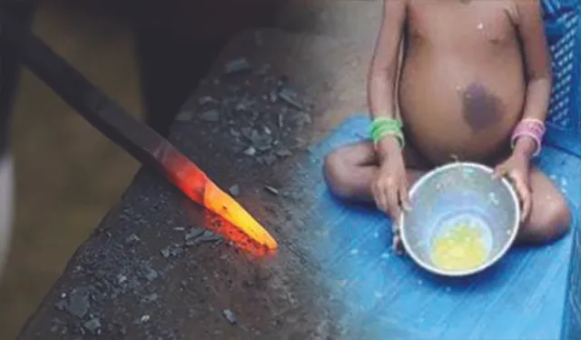 ଶିଳ୍ପାଞ୍ଚଳରେ ଅନ୍ଧବିଶ୍ବାସ: ଅପପୁଷ୍ଟିର ଶିକାର ଶିଶୁକୁ ଚେଙ୍କ