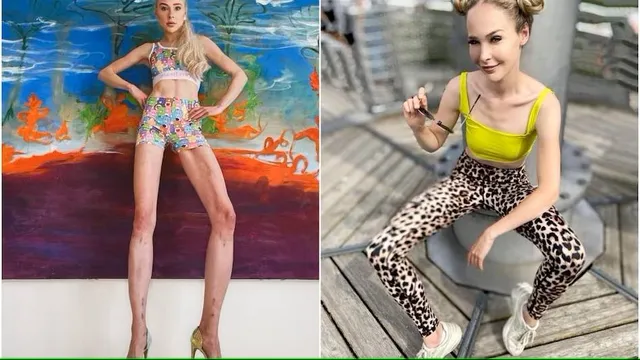 ଗୋଡ଼ ଲମ୍ବା କରିବା ପାଇଁ ମହିଳା ଆପଣାଇଲେ ଏଭଳି ଉପାୟ