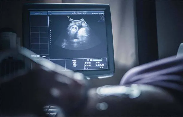 କଟକରେ ଅବୈଧ ଭ୍ରୂଣ ନିରୂପଣ ଓ ଗର୍ଭନଷ୍ଟର ରାକେଟ୍‌