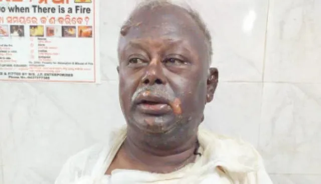 ବାହାନଗା ଟ୍ରେନ ଦୁର୍ଘଟଣା: ପ୍ୟାଣ୍ଟ୍ରିକାର୍‌ରେ ଅଣ୍ଡା ତରକାରୀ କରୁଥିଲି