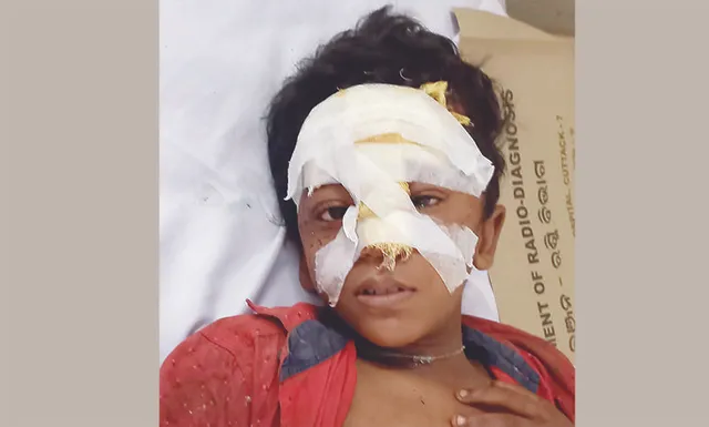 ୧୦ ବର୍ଷ ବାଳକର ଲୋମଟାଙ୍କୁରା କାହାଣୀ...: ୧୦ ଜଣଙ୍କ ତଳେ ଚାପି ହୋଇଯାଇଥିଲି