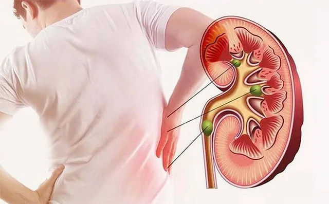 କିଡ୍‌ନି ପ୍ରତିରୋପଣ ସଚେତନତା ନାହିଁ: ନଷ୍ଟ ହେଉଛି ଅମୂଲ୍ୟ ଅଙ୍ଗ, ହୋଇପାରୁନି ମୃତବ୍ୟକ୍ତିଙ୍କ ଅଙ୍ଗଦାନ