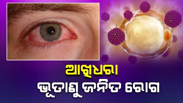 ଆଖିଧରା ସ୍ଥିତି ବିଗିଡ଼ିଲେ ଜାରି ହୋଇପାରେ ମାର୍ଗଦର୍ଶିକା: ଜନସ୍ୱାସ୍ଥ୍ୟ ନିର୍ଦେଶକ