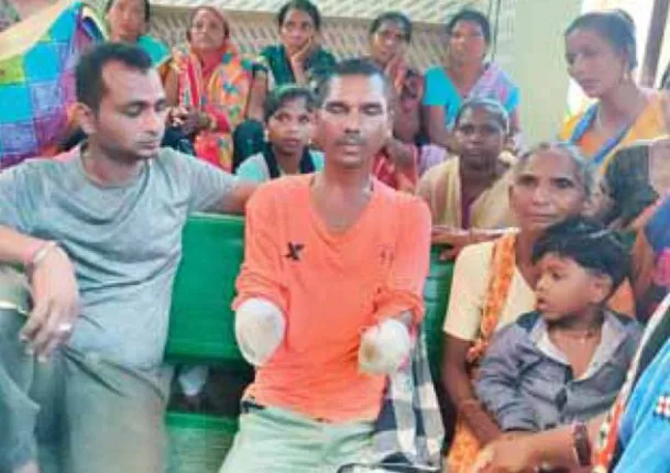 ଦାଦନ ଯନ୍ତ୍ରଣା: ୨ ହାତ ହରାଇ ଫେରିଲେ ଯୁବକ