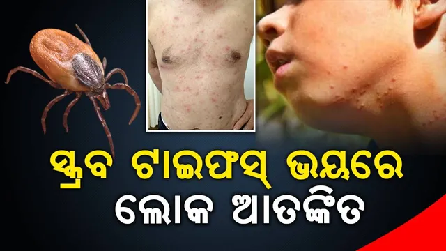 ବରଗଡ଼ରେ ସ୍କ୍ରବ ଟାଇଫସ୍ କୀଟ ଆକ୍ରମଣରେ ୫ ଜଣଙ୍କ ମୃତ୍ୟୁ ! ଆତଙ୍କିତ ହେଉଛନ୍ତି ଲୋକେ