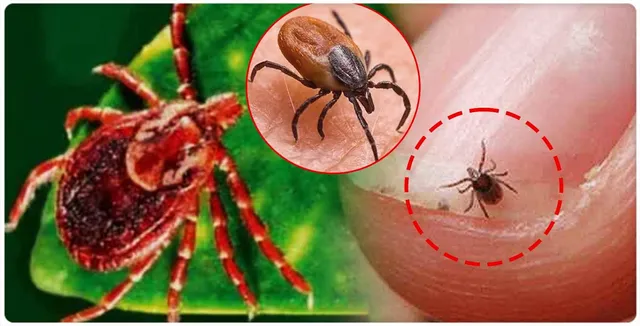 ସୁନ୍ଦରଗଡ଼ ଜିଲ୍ଲାରେ ୬ ନୂଆ ସ୍କ୍ରବ ଟାଇଫସ ରୋଗୀ ଚିହ୍ନଟ: ଆକ୍ରାନ୍ତଙ୍କ ସଂଖ୍ୟା ୩୬୧ରେ ପହଞ୍ଚିଲା