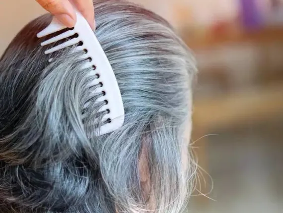 କମ୍‌ ବୟସର ପିଲାଙ୍କର ବି ପାଚି ଯାଉଛି କେଶ; ଏହି ସବୁ କଥାକୁ ଦିଅନ୍ତୁ ଧ୍ୟାନ