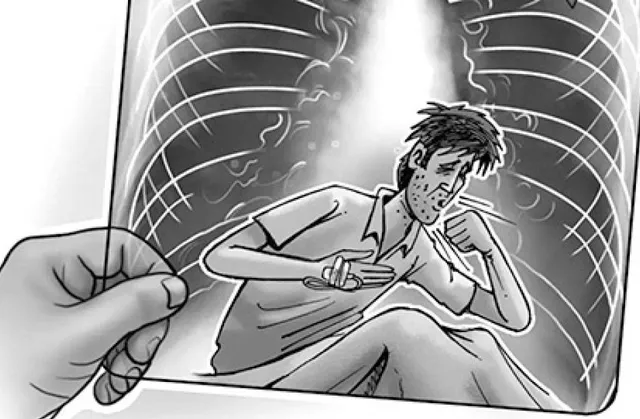 ଦର୍ପଣ: ଯକ୍ଷ୍ମାର ବୋଝ