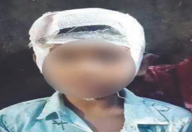 ପ୍ରଧାନଶିକ୍ଷୟିତ୍ରୀଙ୍କ ମାଡ଼ରେ ଛାତ୍ରଙ୍କ ମୁଣ୍ଡ ଫାଟିଲା: ହତ୍ୟା ଉଦ୍ୟମ ମାମଲା ରୁଜୁ, କାର୍ଯ୍ୟାନୁଷ୍ଠାନ ଦାବିରେ ଧାରଣା