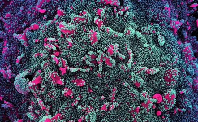 କୋଭିଡ୍‌ର ଏକ୍ସବିବି୧.୫ ପ୍ରଜାତି ପାଇଁ ‘ବାୟୋଲୋଜିକାଲ-ଇ’ ଟିକା