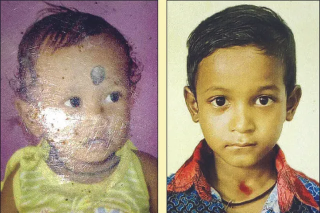 ଏମିତି ବି ଆସେ ମୃତ୍ୟୁ: ଖେଳିବାକୁ ଯାଇ କୂଅରେ ପଡ଼ିଗଲେ ୨ ଭାଇ