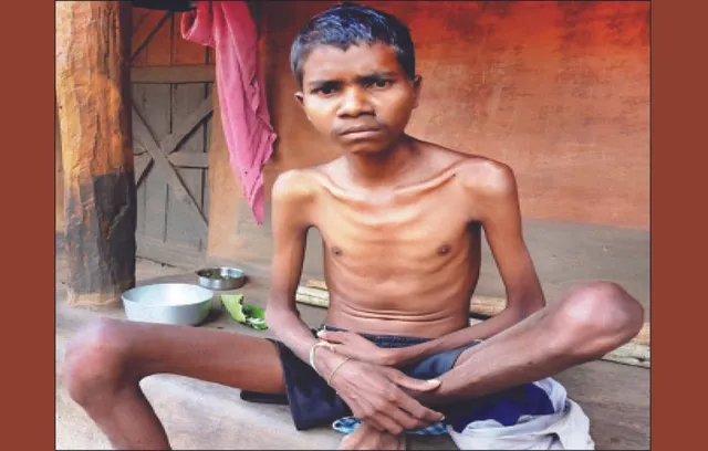 ପାଣିରେ ହେକ୍ସାଭାଲେଣ୍ଟ କ୍ରୋମିୟମ, ବାୟୁରେ ଯକ୍ଷ୍ମା: ସୁକିନ୍ଦା କ୍ରୋମ୍‌ ଉପତ୍ୟକାରେ ମାଳମାଳ ରୋଗୀ