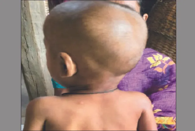 ୨ ମାସ ହେଲା ଜିଲ୍ଲାରେ ଛତୁଆ ଯୋଗାଣ ବନ୍ଦ: ଗାଁଗାଁରେ ଶିଶୁ ଓ ଗର୍ଭବତୀ ପୁଷ୍ଟିଯୁକ୍ତ ଖାଦ୍ୟରୁ ବଞ୍ଚିତ