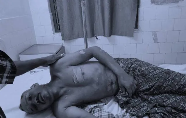 ଅଷ୍ଟପ୍ରହରୀ ନାମଯଜ୍ଞର ରୋଷେଇଶାଳ ଡ଼ାଲିହଣ୍ଡାରେ ପଡ଼ି ରୋଷେୟା ଗୁରୁତର