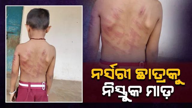 ନର୍ସରି ଛାତ୍ରକୁ ନିସ୍ତୁକ ମାଡ଼ ମାରିଲେ ଘରୋଇ ବିଦ୍ୟାଳୟର ଶିକ୍ଷକ, ଅଭିଯୁକ୍ତ ଗିରଫ
