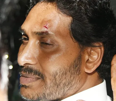 ଆନ୍ଧ୍ରପ୍ରଦେଶ ମୁଖ୍ୟମନ୍ତ୍ରୀ ଜଗନମୋହନ ରେଡ୍ଡିଙ୍କ ଉପରେ ଆକ୍ରମଣ, ଅଳ୍ପକେ ବର୍ତ୍ତିଲେ