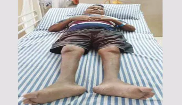 ପ୍ରଭୁକୃପାକୁ ଅନାଇ ବସିଛନ୍ତି ପ୍ରଭୁପ୍ରକାଶ: କିଡ୍‌ନି ପ୍ରତିରୋପଣ ପାଇଁ ଅର୍ଥ ବାଧକ