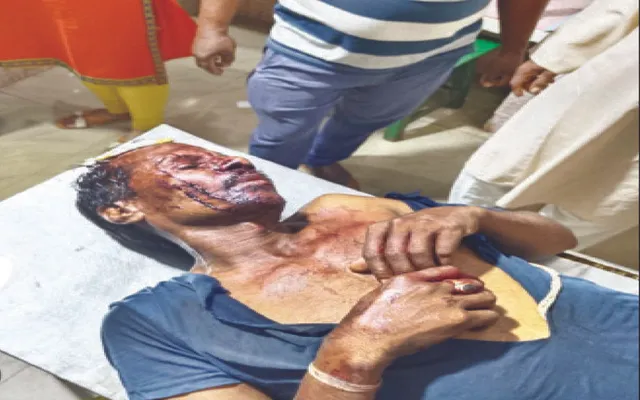 ଘସିପୁରାରେ ବଦ୍ରି ସମର୍ଥକ ରକ୍ତମୁଖା: ସୌମ୍ୟଙ୍କ ସମର୍ଥକଙ୍କୁ ପ୍ରାଣାନ୍ତକ ଆକ୍ରମଣ