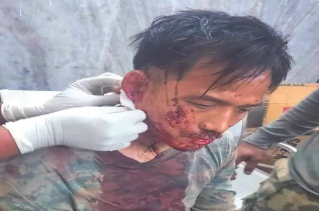 ସୀମାନ୍ତରେ ଗୁଳି ବିନିମୟ: ଯବାନଙ୍କ ବେକରେ ନକ୍ସଲଙ୍କ ଗୁଳି