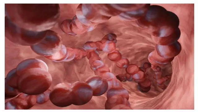 ମଣିଷ ପାଇଁ ନୂଆ ବିପଦ: ଜାପାନରେ ମାଂସ ଖାଉଥିବା ବ୍ୟାକ୍ଟେରିଆ ଦ୍ରୁତ ଗତିରେ ବ୍ୟାପୁଛି, ମାତ୍ର ୨ ଦିନରେ ଜୀବନ ନେଉଛି