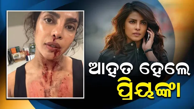 ସିନେମା ସୁଟିଂ ବେଳେ ଆହତ ହେବାର ଭିଡିଓ ପୋଷ୍ଟ କଲେ ପ୍ରିୟଙ୍କା