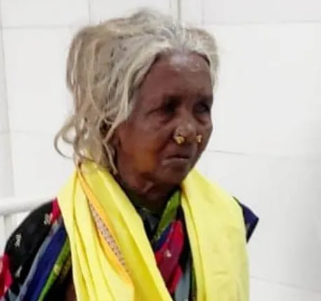 ଏସସିବି ମେଡିକାଲରେ ଚିକିତ୍ସାଧୀନ ଅବସ୍ଥାରେ ପଦ୍ମଶ୍ରୀ କମଳା ପୂଜାରୀଙ୍କ ପରଲୋକ