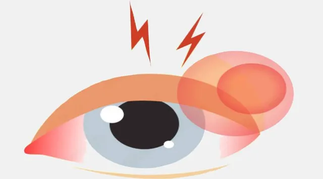 ମାଡ଼ିଚାଲିଛି ପିଲାଙ୍କ ଜ୍ବର, ଆଖିଧରା: କମୁଛି ଉପସ୍ଥାନ