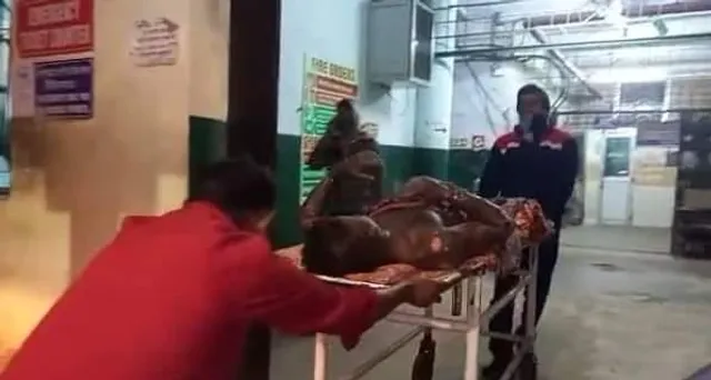 পিঠে পুলি তৈরী করার সময় অগ্নিদগ্ধ হলেন স্বামী-স্ত্রী