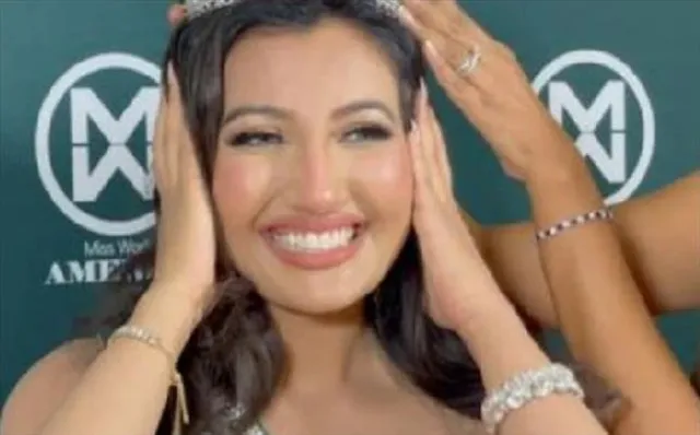 ভারতীয় বংশোদ্ভূত, পুড়ে যাওয়া মুখ নিয়েই 'মিস ওয়ার্ল্ড আমেরিকা' খেতাব
