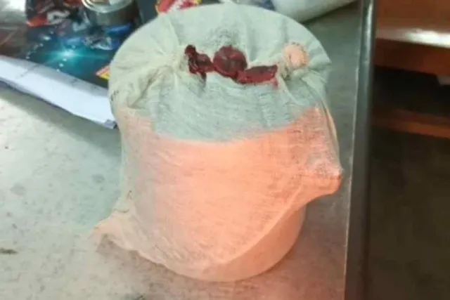 উদ্ধার বিপুল পরিমাণ পোস্তর খোল এবং আফিম