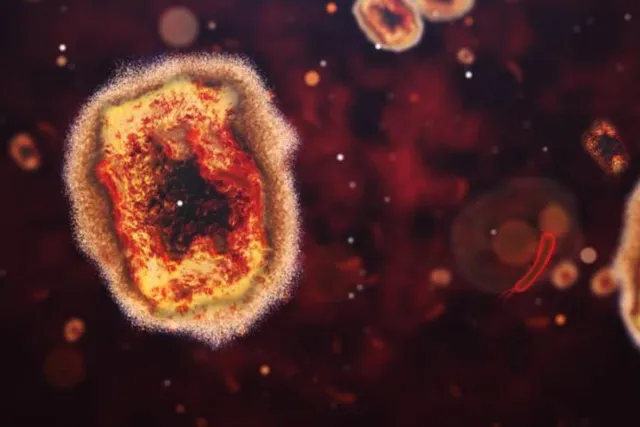 সেরে উঠলেন প্রথম মাক্সিপক্সে আক্রান্ত রোগী