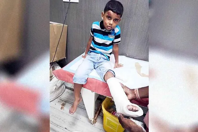 বাবুঘাটে ক্রেনের ধাক্কায় আহত বালক