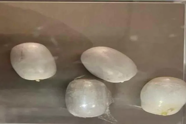 মলদ্বারে সোনা লুকিয়ে পাচারের চেষ্টা বিমান যাত্রীর